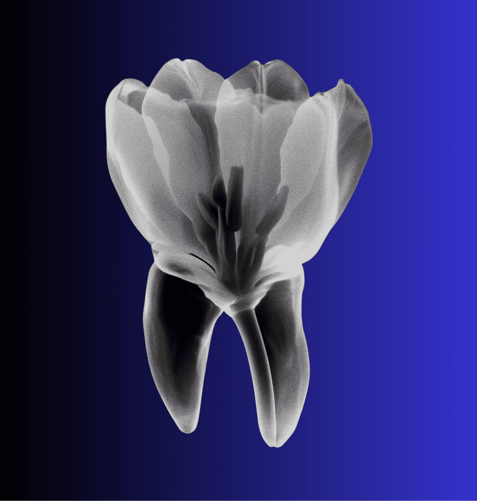 X-ray art of a tooth blooming like a flower