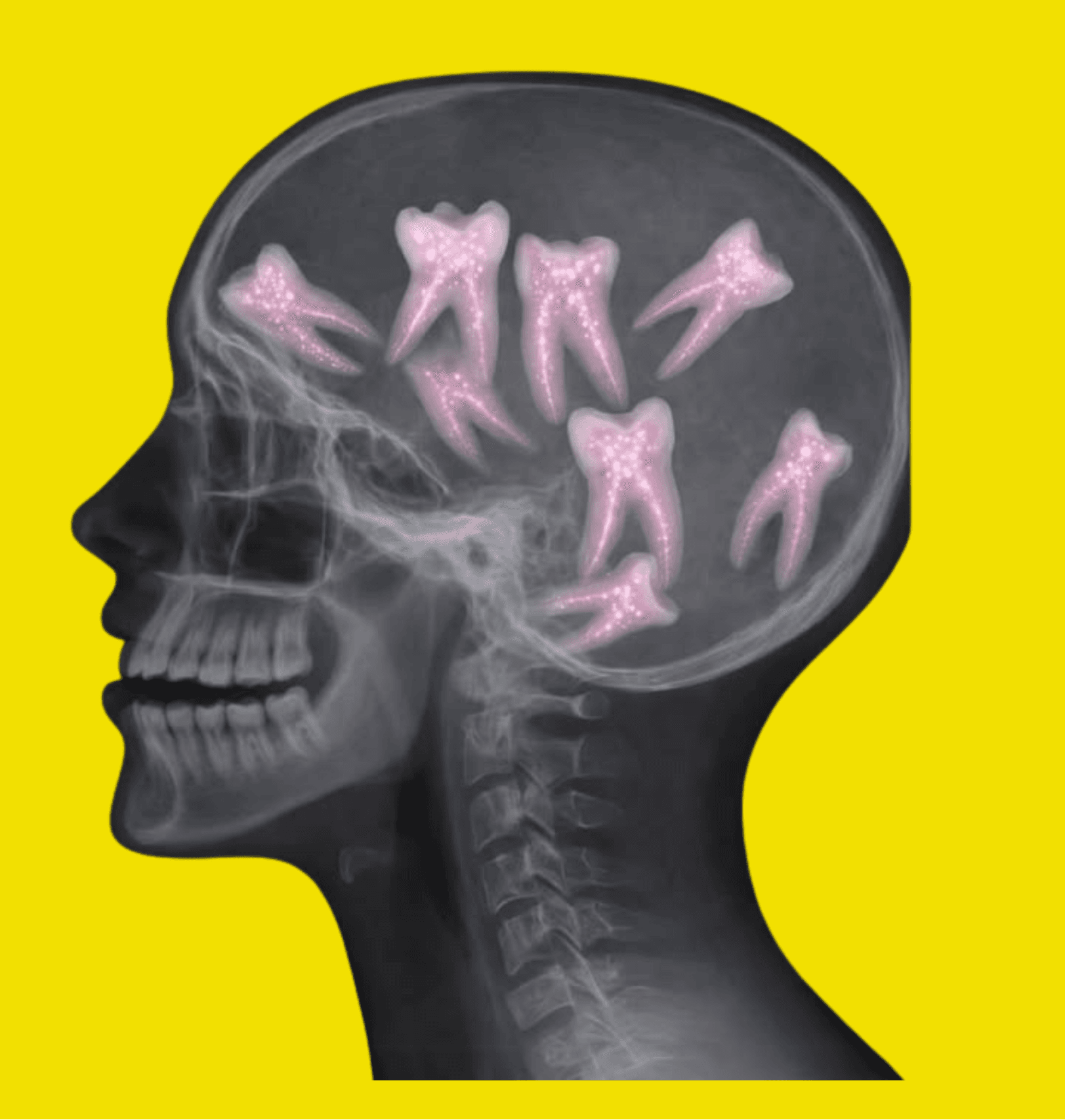 X-ray of a head with teeth in place of the brain